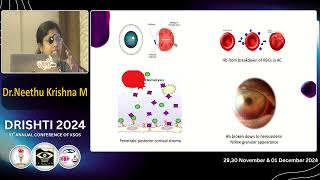 KSOS2024 IC102 T Dr NEETHU KRISHNA M The bloody eye   Management pearls of traumatic hyphema