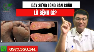 Dày sừng lòng bàn chân là bệnh gì?  | ĐÔNG DƯỢC GIA TRUYỀN