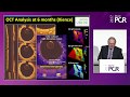 How a unique DES platform translates into clinical differentiation with MiStent - EuroPCR 2017