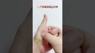 人发烧掐鱼际穴。