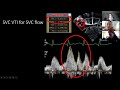 views and measurements in neonatal echocardiography part 2