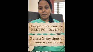 CHEST XRAY SIGNS OF PULMONARY EMBOLISM WITH EASY MNEMONIC FOR NEET PG , FMGE AND INICET#neetpg2024