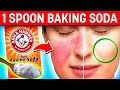 10 POWERFUL Ways 1 Spoonful Of Baking Soda DAILY Can Change Your Life