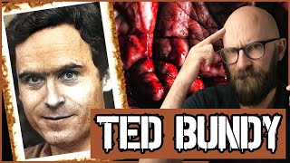 Ted Bundy: Sexual Sadist and Psychopath