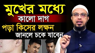 মুখের মধ্যে কালো দাগ পড়া কিসের লক্ষন জানলে চমকে যাবেন=আহমাদুল্লাহ,Sheikh Ahmadullah=14/12/24 #waz