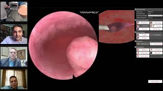 VirtaMedEd Hysteroscopy highlights with Vessalka