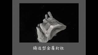 牙髓 牙周 膺復合併症 根尖病變 #26