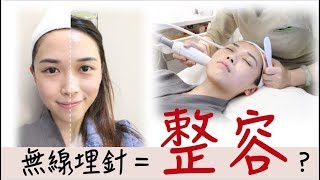 《Beauty F-log》一齊去做無針埋線｜V臉效果超誇張｜痛唔痛？