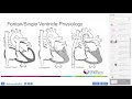 How to perform Cardiopulmonary Exercise Testing in Congenital Heart Disease ?