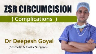 Complications Of ZSR Circumcision | ZSR Circumcision ke kya Complications |