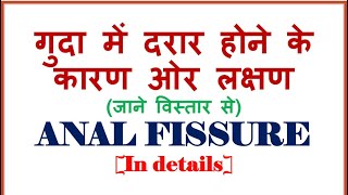 Anal Fissure । गुदा में दरार होने के करण ओर लक्षण #CauseofFissure  #Analfissure  #Fissure