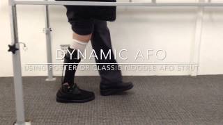 Custom Dynamic AFO using the Kinetic Research Strut