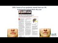 toyos lecture new dry eye treatment optima ipl update