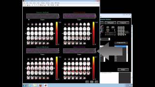 Group ICA fMRI Toolbox (GIFT)