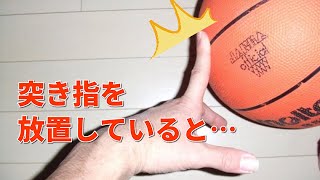 突き指を治す方法！正しいテーピングの巻き方とは？