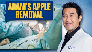 Adam's Apple Removal