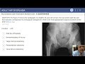 adult hip dysplasia exam review william jiranek md