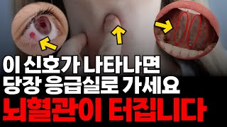 ‘목, 눈, 혀’에 나타나는 뇌졸중 신호! 당장 병원 가셔야 합니다 “뇌 혈관 터지기 직전의 신호”