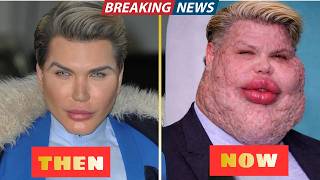 10 celebrity plastic surgery disasters you'd never recognize today | Then and Now Photos 2026