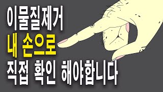 【CN SUB】이물질 제거 후에도 여전히 만져지는데도 이 정도가 최선이라고 말하는 병원에서는 수술 받지 마세요. 이물질제거는 내 손으로 안 만져질 때까지 제거가 되어야 합니다.