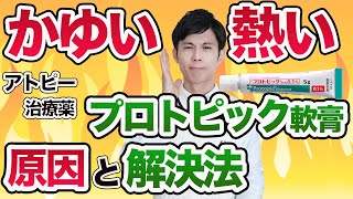 アトピー治療薬 プロトピック軟膏のヒリヒリ感・かゆみを解消する方法 ５選