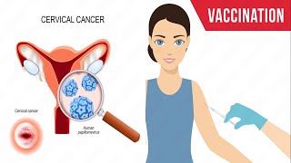 HPV Vaccine: Who Needs It and Why?