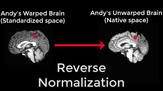 Reverse Normalization of fMRI Data
