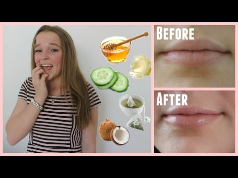 Easy Ways to Cure Chapped Lips in Minutes! Easy Ways to Cure Chapped Lips in Minutes!
