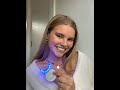 Get A Whiter Smile Instantly With Australia's Best Whitening Kit - Smilie