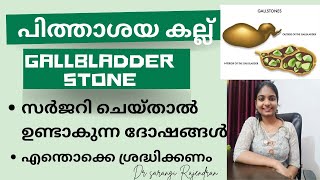 പിത്താശയ കല്ല്/gall bladder stone/സർജറി ചെയ്താൽ ഉണ്ടാകുന്ന ദോഷങ്ങൾ/Dr sarangi Rajendran/#gallbladder