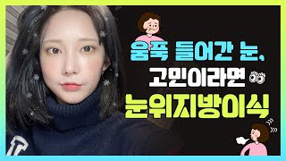 쌍꺼풀 수술 후 부작용? | 움푹 들어간 눈 눈위지방이식으로 해결  | CASE.07 | 메이트성형외과