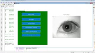 Robust Iris Segmentation matlab projects