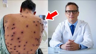 Man Thought He Had 'Bed Bugs,' but Expert Is Put Off by What They Really Are