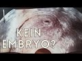 My miscarriage / 8. week of pregnancy / amniotic sac without Embryo