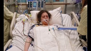 Extubation and first breaths after double lung transplant - Cystic Fibrosis