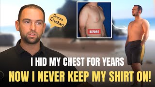 Gynecomastia Surgery - Improves Self Confidence, Intimacy