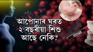 আপোনাৰ ঘৰত ২ বছৰীয়া শিশু আছে নেকি? HMPV ভাইৰাছৰ চিকিৎসা কেনেদৰে কৰা হয়?