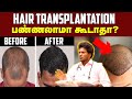Hair Fall Solution : முடி கொட்டுதா இனி கவலைப்படாதீங்க | Best Treatment For Hair Fall | Health