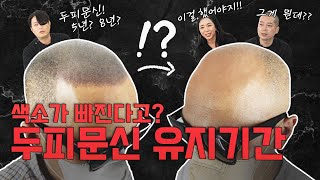 두피문신 유지기간은 어느정도일까? 5년? 10년? 유지기간 늘리려면 바로 이 방법 알아야한다![부산 두피문신 | 하이스칼프 | 탈모 | 대머리]