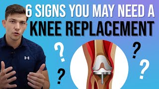 6 Signs a Knee Replacement Is Needed (for Knee Arthritis)