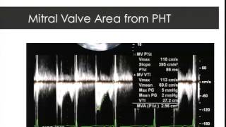 Dr Bruce Cartwright: Intraoperative Echocardiographic Assessment During Mitral Valve Repair