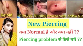 क्या New Piercing में Piercing Bumps, Yellow/White pus, Bleeding होना Normal है  🤔 l Home remedies l