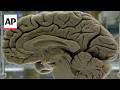 Brain exercises lower risk of Alzheimer's disease and cognitive decline, study shows