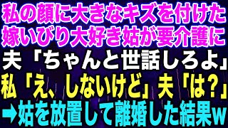 【スカッと総集編】私の顔に大きなキズを付けた、嫁いびり大好き姑が要介護に。夫「ちゃんと世話しろよ」私「え、しないけど」夫「は？」➡︎姑を放置して離婚した結果w【修羅場】