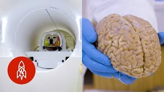 4 Mind-Blowing Stories About the Brain