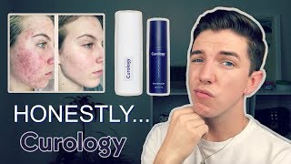 Curology *NOT SPONSORED*  Review | Is It Legit?