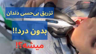 تزریق بی حسی عصب آلوئولار تحتانی با استفاده از سیستم تزریق بی حسی دیجیتال در دندانپزشکی