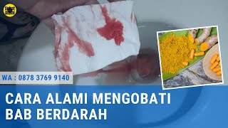 Cara Alami Mengobati Bab Berdarah Menetes Mengucur Tidak Terasa Sakit