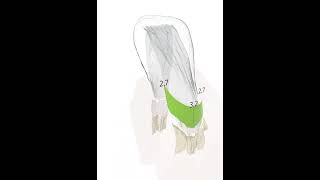 Perceptive OCT Periodontal Pocket Demo