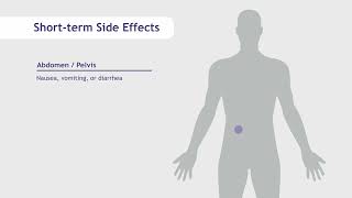 Side Effects of Radiation Therapy | SERO